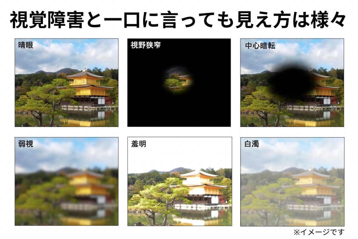 金閣寺の画像が6つ並んでいる。左上から晴眼、視野狭窄、中心暗転、左下から弱視（低視力）、羞明、白濁